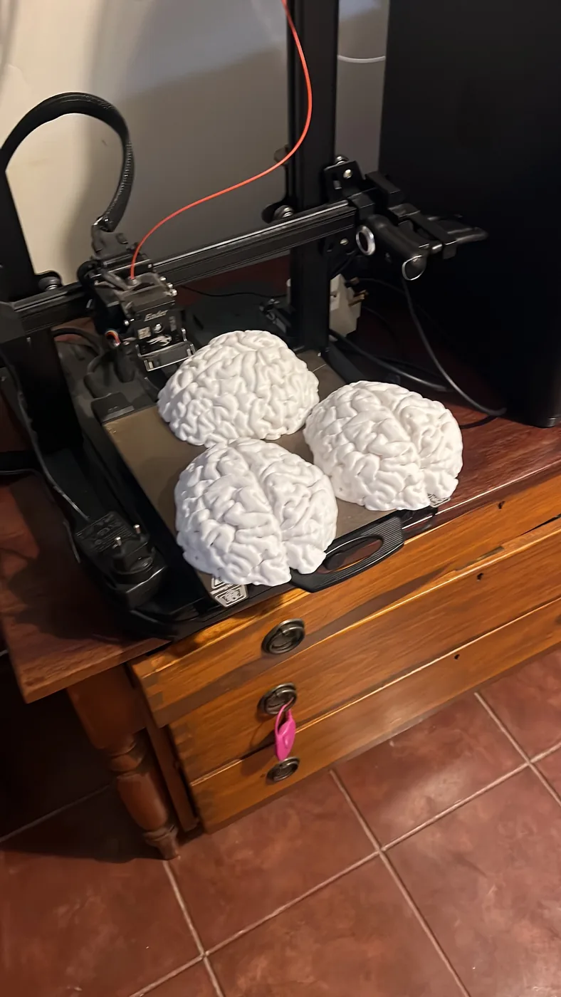 3D printed anatomical brain models